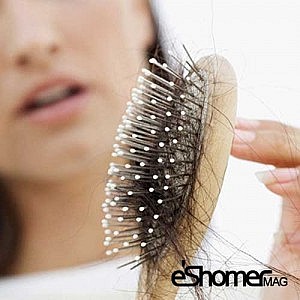 مجله خبری ایشومر hair-loss-mag-eshomer-300x300 برخی ازعادات نادرست که باعث ریزش مو می شوند سبک زندگی سلامت و پزشکی  نادرست مو عادات ریزش برخی باعث  