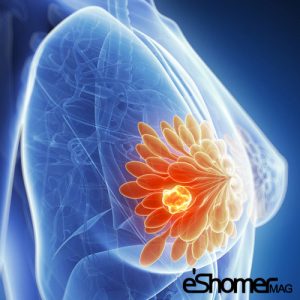 مجله خبری ایشومر Prevention-of-breast-cancer-by-changing-the-way-you-eat-mag-eshomer-300x300 پیشگیری از سرطان سینه  با تغییر در نحوه غذا خوردن سبک زندگی سلامت و پزشکی  وزن نحوه کاهش غذا سینه سلامت سرطان خوردن تغییر پیشگیری  