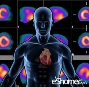 مجله خبری ایشومر Scanning-the-heart-of-why-and-how-it-is-done-mag-eshomer-300x294 اسکن قلب چرا و چگونه انجام می شود سبک زندگی سلامت و پزشکی  قلب عروق سلامت و پزشکی سلامت سکته درمان بیماری های قلبی بیماری اسکن  