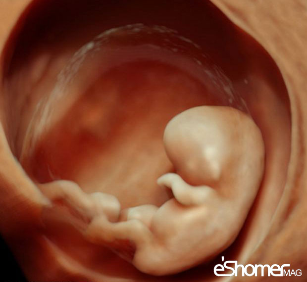 بهترین زمان برای انجام سونوگرافی سه بعدی و چهار بعدی برای تعیین جنسیت جنین