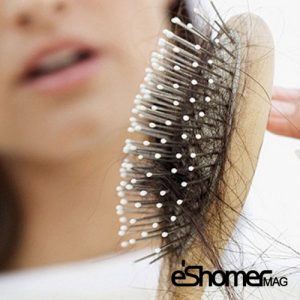 علت ریزش موهای سر و درمان آن به روش خانگی 4