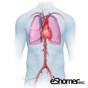 آنژیوگرافی قلب چگونه انجام می شود