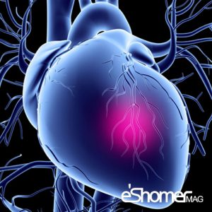 روش درمان اختلالات عروق کرونر قلب در بیمارستان چیست