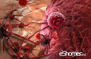 سرطان خون چیست و نشانه ها و علائم آن کدامند؟